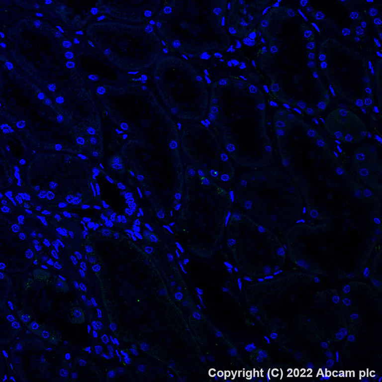 Immunohistochemistry - Alexa Fluor® 555 Anti-HLA-DPB1 antibody [EPR11226] (AB300098)