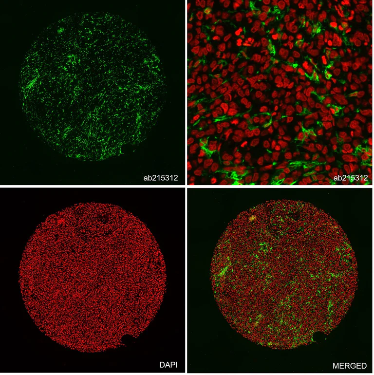 Multiplex immunohistochemistry - Alexa Fluor® 555 Anti-HLA-DR antibody [EPR3692] (AB215312)