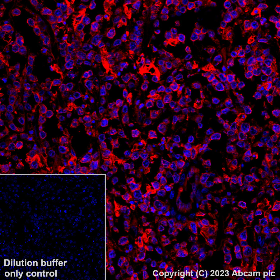 Immunohistochemistry (Formalin/PFA-fixed paraffin-embedded sections) - Alexa Fluor® 555 Anti-HLA-DR antibody [TAL 1B5] (AB309506), expandable thumbnail