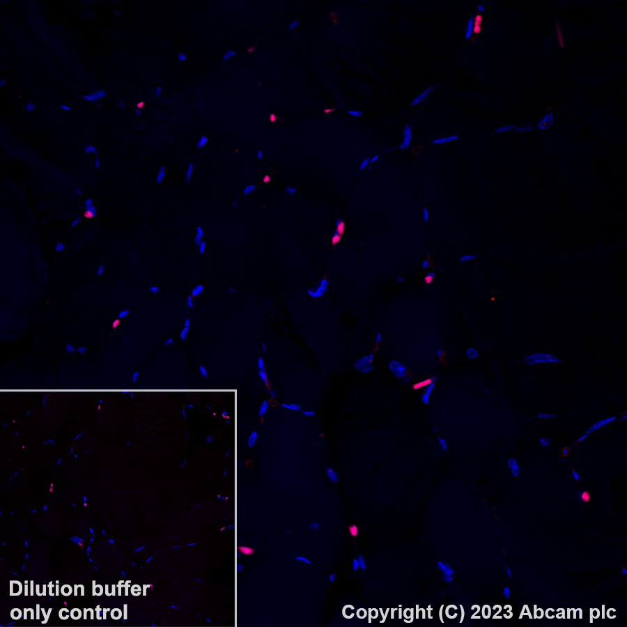 Immunohistochemistry (Formalin/PFA-fixed paraffin-embedded sections) - Alexa Fluor® 555 Anti-HLA-DR antibody [TAL 1B5] (AB309506), expandable thumbnail