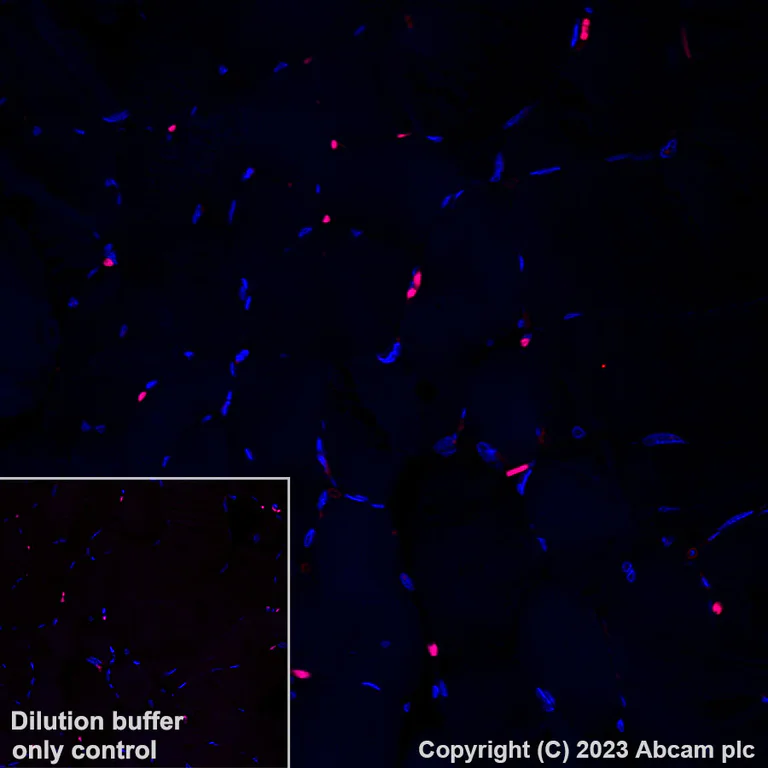 Immunohistochemistry (Formalin/PFA-fixed paraffin-embedded sections) - Alexa Fluor® 555 Anti-HLA-DR antibody [TAL 1B5] (AB309506)