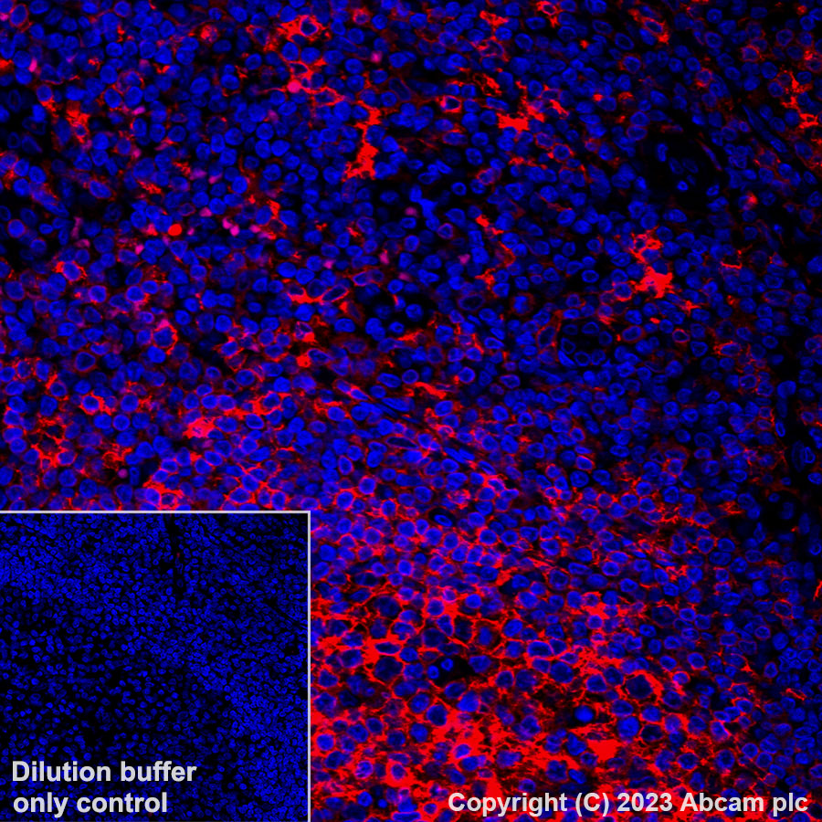 Immunohistochemistry (Formalin/PFA-fixed paraffin-embedded sections) - Alexa Fluor® 555 Anti-HLA-DR antibody [TAL 1B5] (AB309506), expandable thumbnail