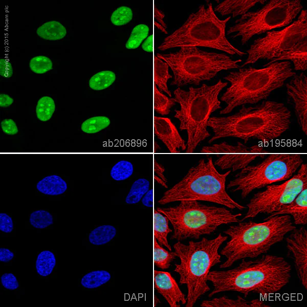 Immunocytochemistry/ Immunofluorescence - Alexa Fluor® 555 Anti-HMGB1 antibody [EPR3507] (AB206896)