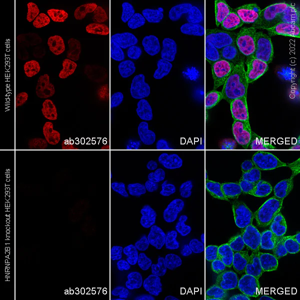 Immunocytochemistry/ Immunofluorescence - Alexa Fluor® 555 Anti-hnRNP A2B1 antibody [EPR24002-81] (AB302576)