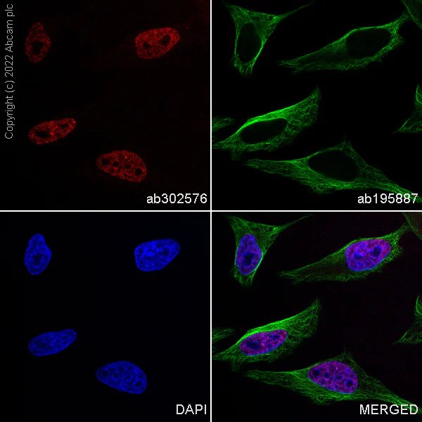 Immunocytochemistry/ Immunofluorescence - Alexa Fluor® 555 Anti-hnRNP A2B1 antibody [EPR24002-81] (AB302576)