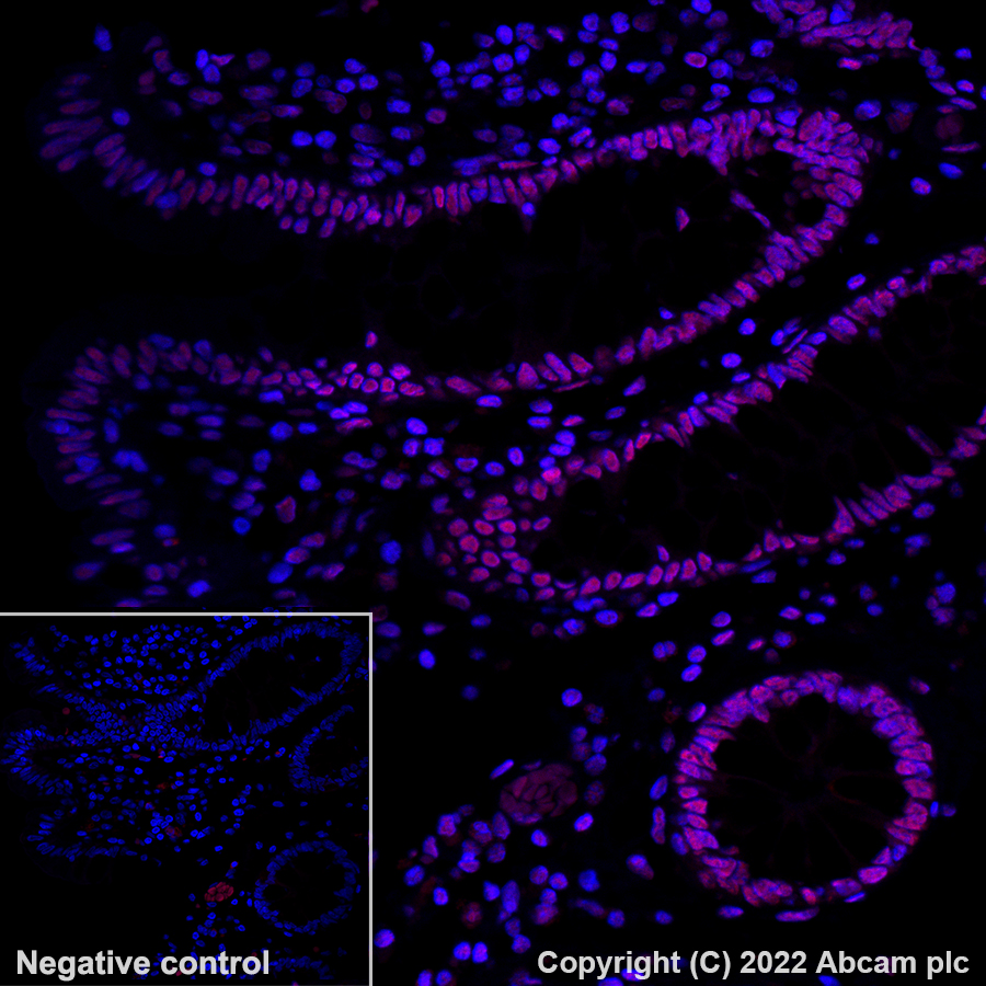 Immunohistochemistry - Alexa Fluor® 555 Anti-hnRNP A2B1 antibody [EPR24002-81] (AB302576), expandable thumbnail