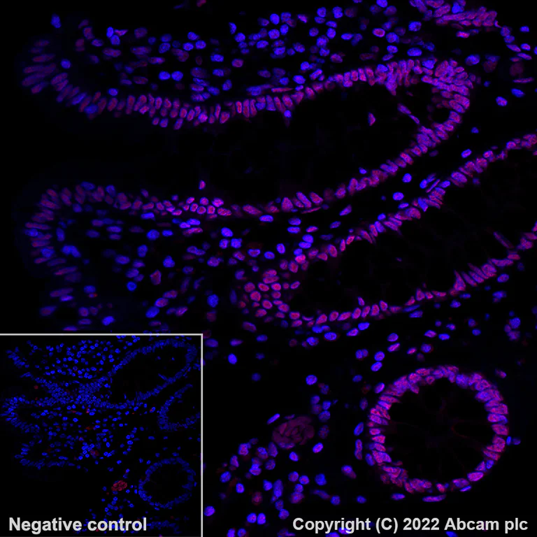 Immunohistochemistry - Alexa Fluor® 555 Anti-hnRNP A2B1 antibody [EPR24002-81] (AB302576)