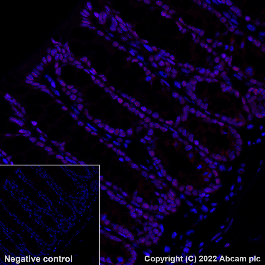 Immunohistochemistry - Alexa Fluor® 555 Anti-hnRNP A2B1 antibody [EPR24002-81] (AB302576), expandable thumbnail