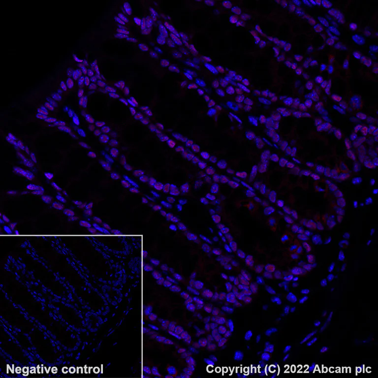 Immunohistochemistry - Alexa Fluor® 555 Anti-hnRNP A2B1 antibody [EPR24002-81] (AB302576)