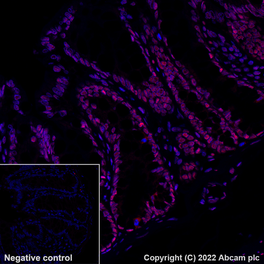 Immunohistochemistry - Alexa Fluor® 555 Anti-hnRNP A2B1 antibody [EPR24002-81] (AB302576), expandable thumbnail