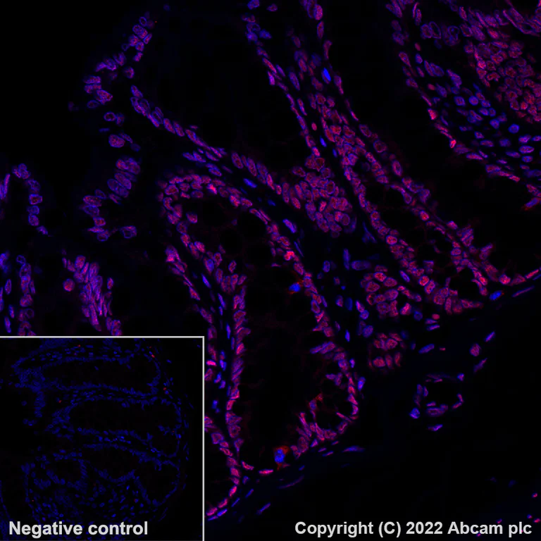 Immunohistochemistry - Alexa Fluor® 555 Anti-hnRNP A2B1 antibody [EPR24002-81] (AB302576)