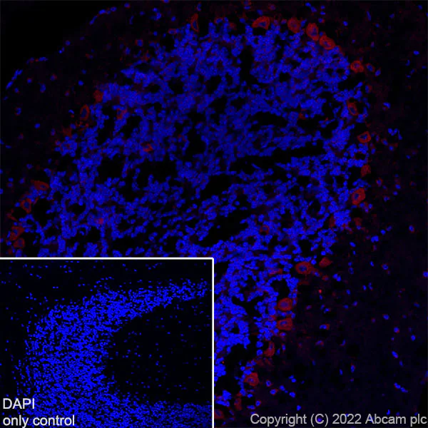 Immunohistochemistry (Frozen sections) - Alexa Fluor® 555 Anti-Huntingtin antibody [EPR5526] (AB302550)