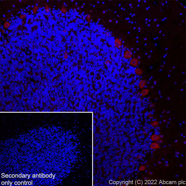 Immunohistochemistry (Frozen sections) - Alexa Fluor® 555 Anti-Huntingtin antibody [EPR5526] (AB302550)