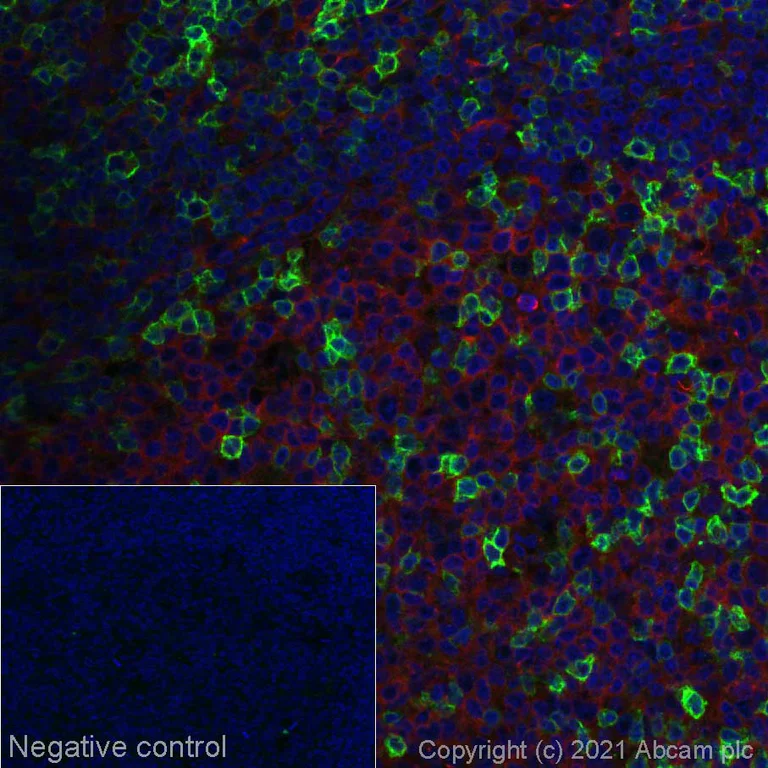 Immunohistochemistry (Formalin/PFA-fixed paraffin-embedded sections) - Alexa Fluor® 555 Anti-ICOS antibody [EPR20560] (AB283488)