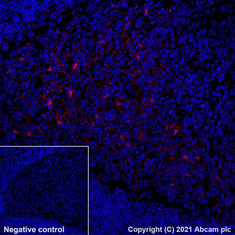Immunohistochemistry (Formalin/PFA-fixed paraffin-embedded sections) - Alexa Fluor® 555 Anti-Indoleamine 2, 3-dioxygenase antibody [EPR20374] (AB281769)