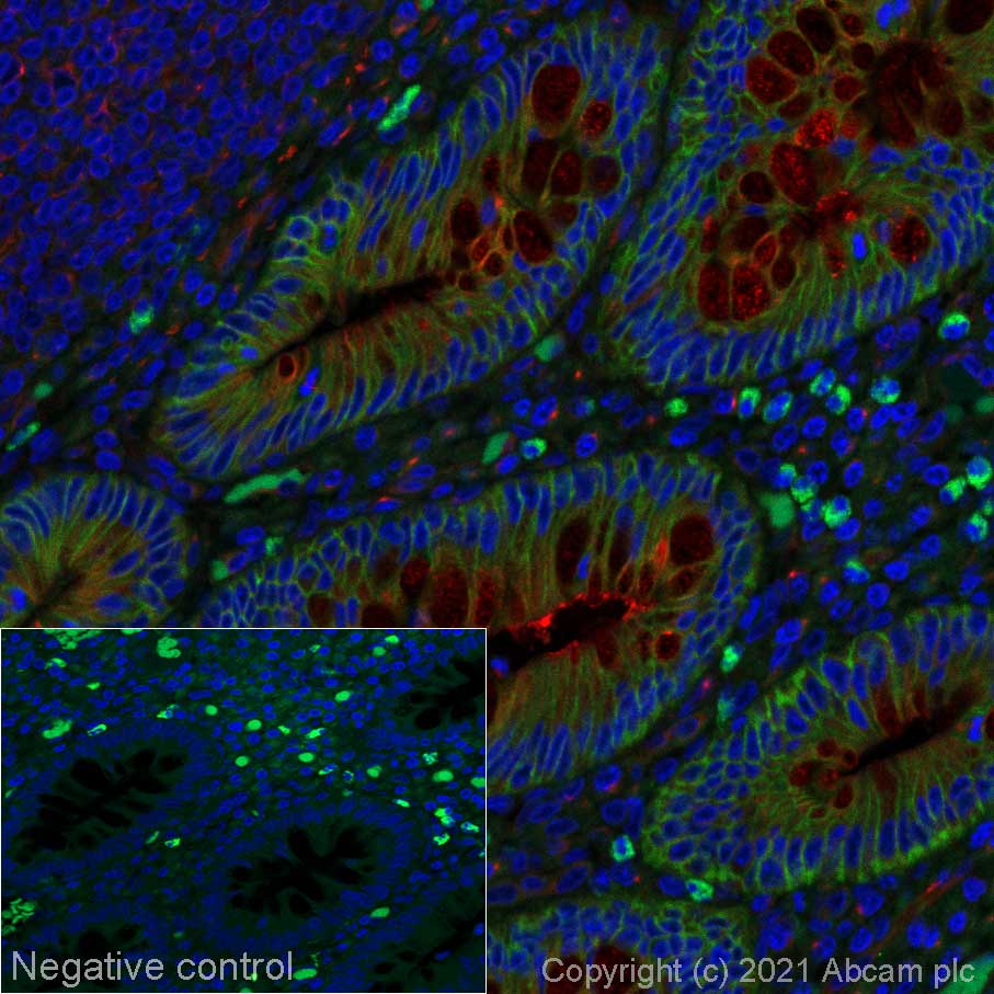 Immunohistochemistry (Formalin/PFA-fixed paraffin-embedded sections) - Alexa Fluor® 555 Anti-Integrin alpha 2 antibody [EPR17338] (AB280853)