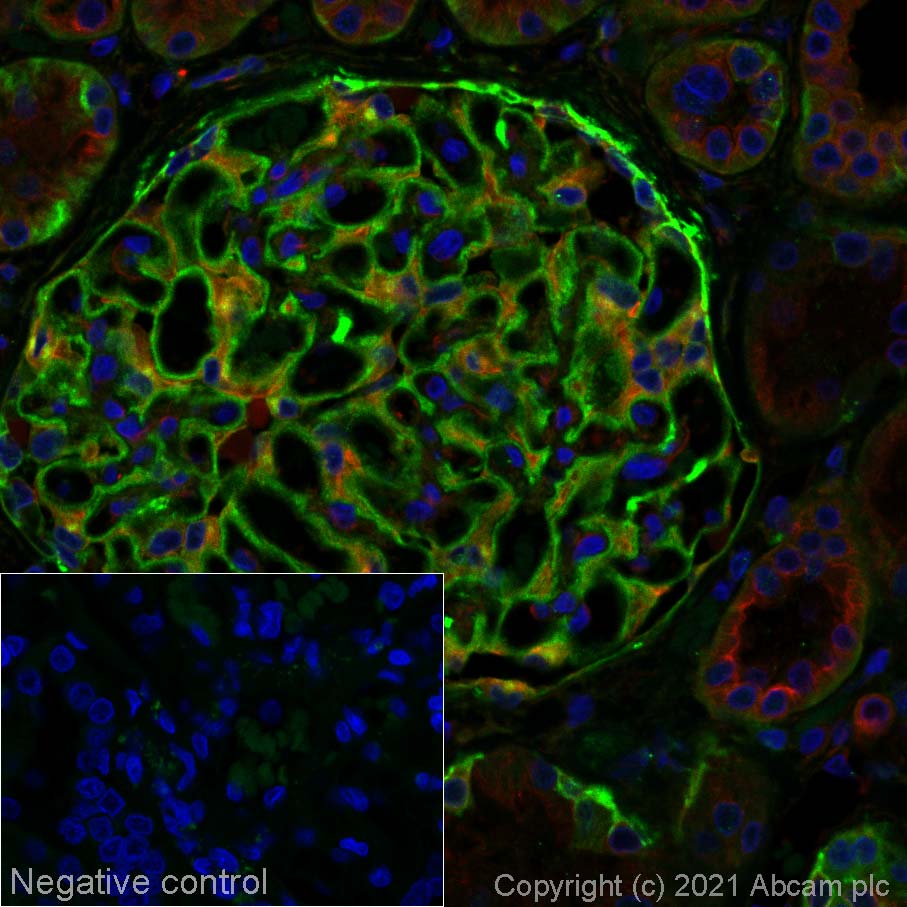 Immunohistochemistry (Formalin/PFA-fixed paraffin-embedded sections) - Alexa Fluor® 555 Anti-Integrin alpha V antibody [EPR16800] (AB275351), expandable thumbnail