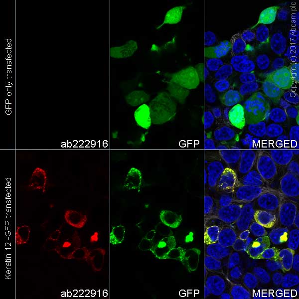 Immunocytochemistry/ Immunofluorescence - Alexa Fluor® 555 Anti-Keratin 12/K12 antibody [EPR17882] (AB222916)