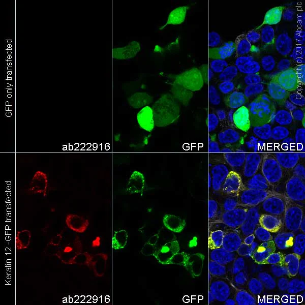 Immunocytochemistry/ Immunofluorescence - Alexa Fluor® 555 Anti-Keratin 12/K12 antibody [EPR17882] (AB222916)