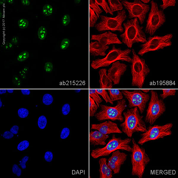 Anti-Ki67 Alexa Fluor® 555 antibody [EPR3610] (ab215226) IgG | Abcam