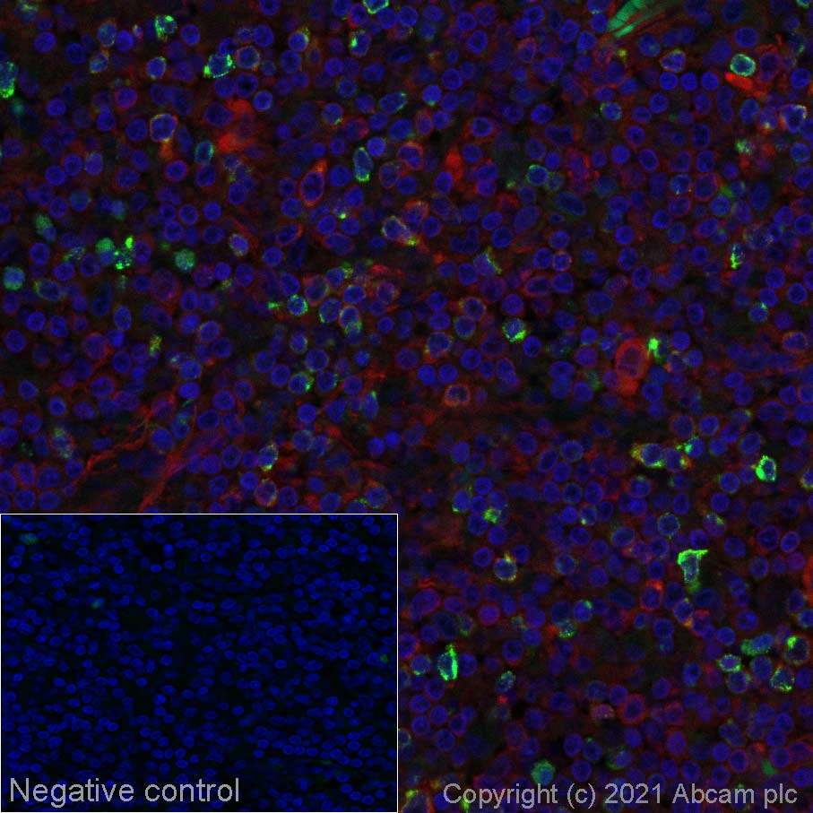 Immunohistochemistry (Formalin/PFA-fixed paraffin-embedded sections) - Alexa Fluor® 555 Anti-LAG-3 antibody [EPR20261] (AB280858), expandable thumbnail