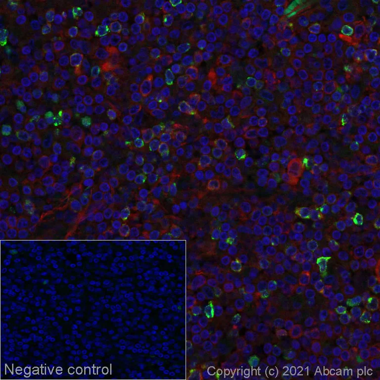 Immunohistochemistry (Formalin/PFA-fixed paraffin-embedded sections) - Alexa Fluor® 555 Anti-LAG-3 antibody [EPR20261] (AB280858)