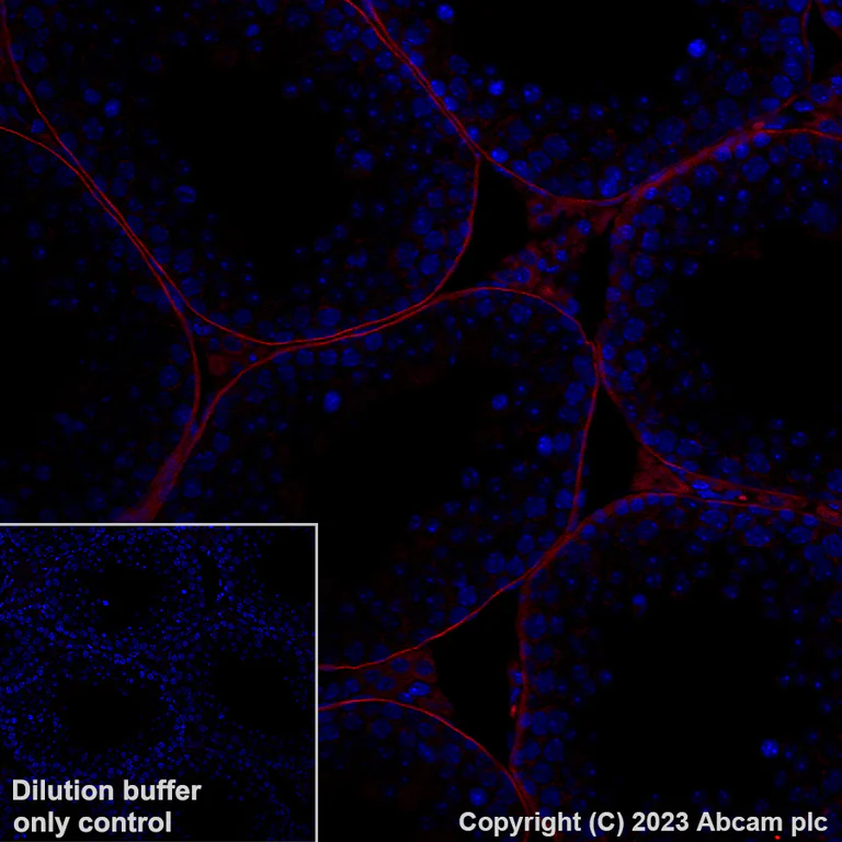 Immunohistochemistry (Formalin/PFA-fixed paraffin-embedded sections) - Alexa Fluor® 555 Anti-LAMA1 antibody [EPR27258-37] (AB314883)
