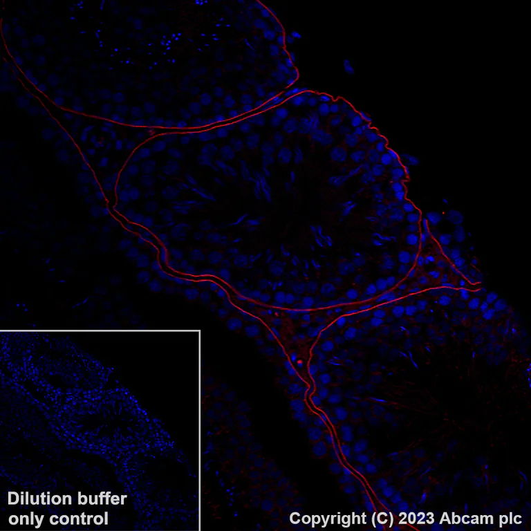 Immunohistochemistry (Formalin/PFA-fixed paraffin-embedded sections) - Alexa Fluor® 555 Anti-LAMA1 antibody [EPR27258-37] (AB314883)