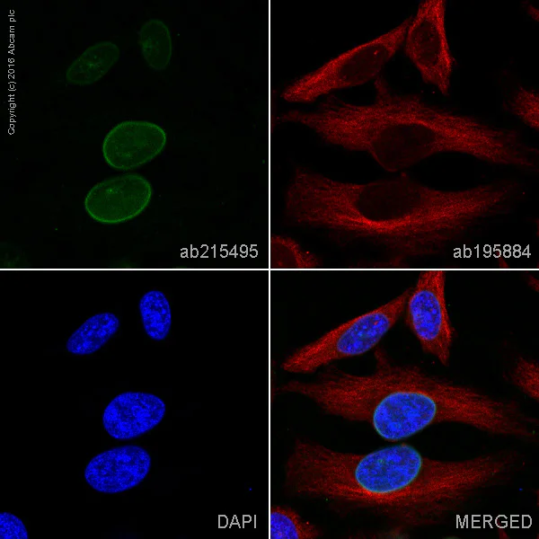 Immunocytochemistry/ Immunofluorescence - Alexa Fluor® 555 Anti-Lamin A + Lamin C antibody [EP4520-16] (AB215495)