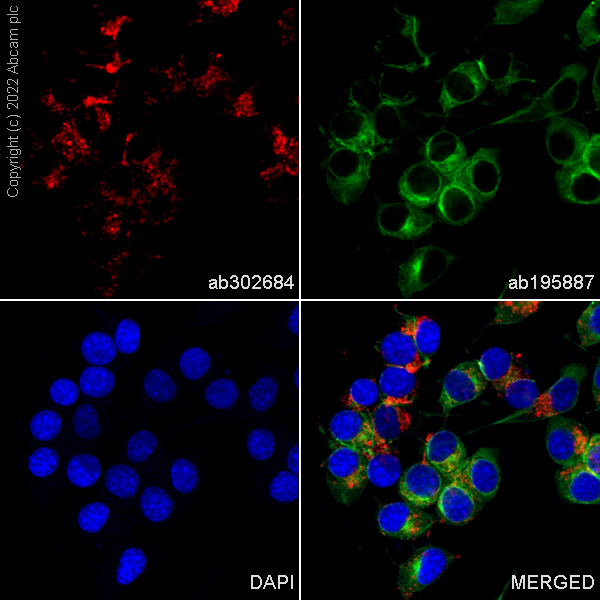 Immunocytochemistry/ Immunofluorescence - Alexa Fluor® 555 Anti-LAMP1 antibody [EPR21026] (AB300550), expandable thumbnail