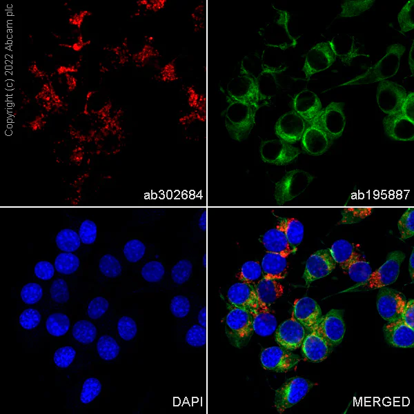 Immunocytochemistry/ Immunofluorescence - Alexa Fluor® 555 Anti-LAMP1 antibody [EPR21026] - Lysosome Marker (AB300550)