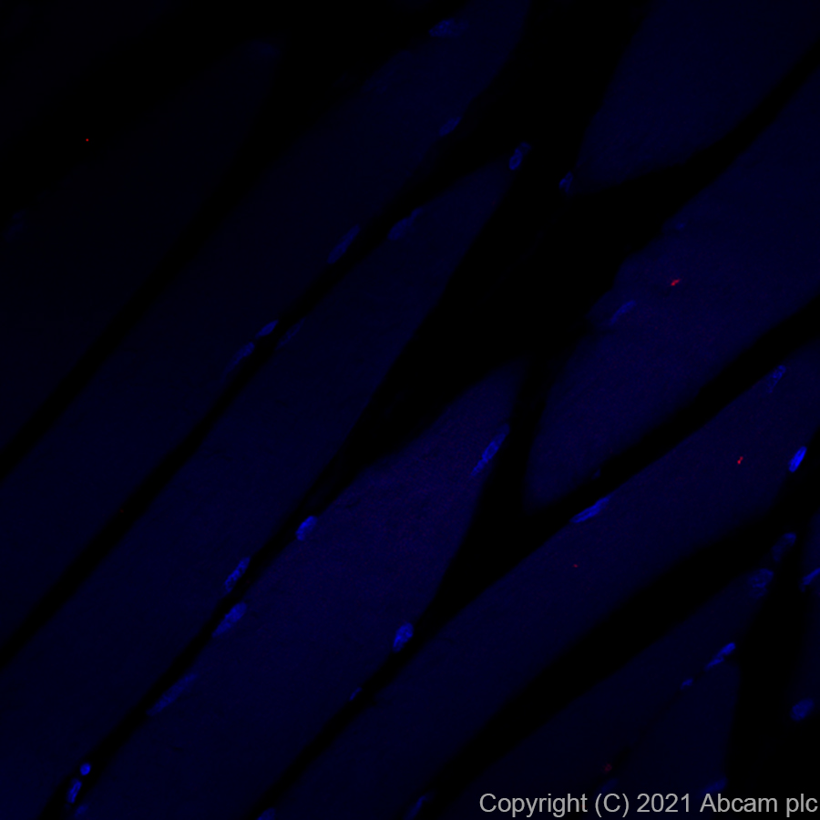 Immunohistochemistry (Formalin/PFA-fixed paraffin-embedded sections) - Alexa Fluor® 555 Anti-LAMP2A antibody [EPR4207(2)] (AB282009), expandable thumbnail