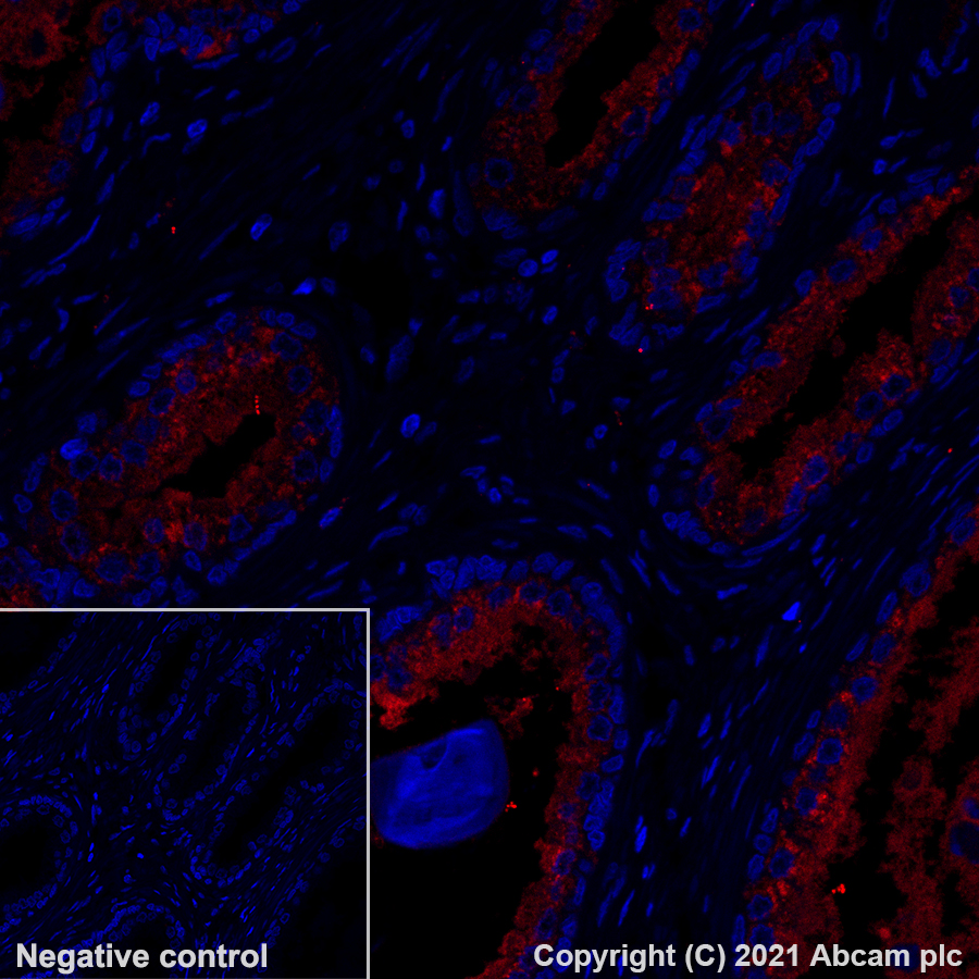 Immunohistochemistry (Formalin/PFA-fixed paraffin-embedded sections) - Alexa Fluor® 555 Anti-LAMP2A antibody [EPR4207(2)] (AB282009), expandable thumbnail