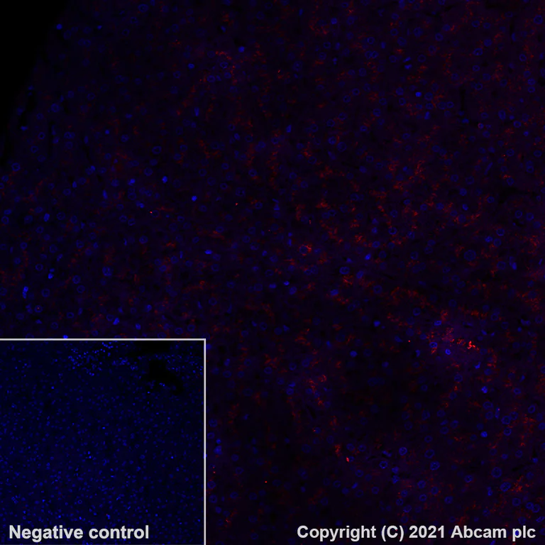 Immunohistochemistry (Formalin/PFA-fixed paraffin-embedded sections) - Alexa Fluor® 555 Anti-LAMP2A antibody [EPR4207(2)] - Lysosome Marker (AB282009)