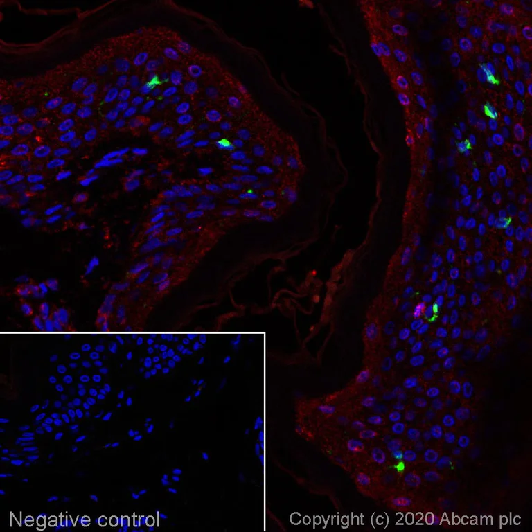 Immunohistochemistry (Formalin/PFA-fixed paraffin-embedded sections) - Alexa Fluor® 555 Anti-Langerin antibody [EPR15863] (AB274894)