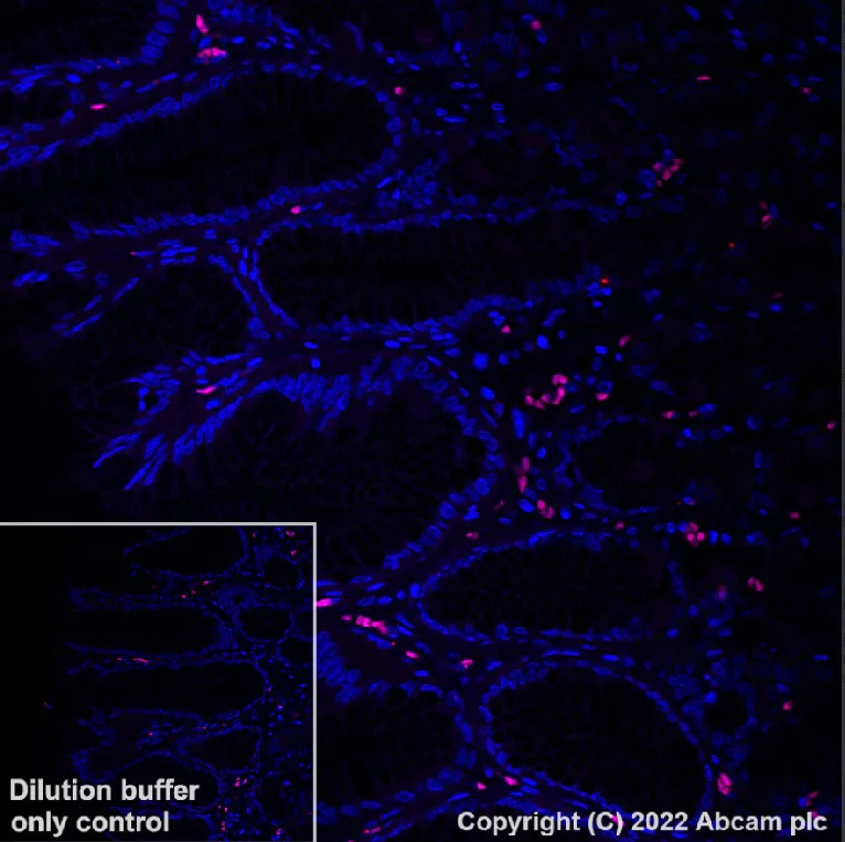 Immunohistochemistry (Formalin/PFA-fixed paraffin-embedded sections) - Alexa Fluor® 555 Anti-LC3B - Autophagosome Marker antibody [EPR18709] (AB307768)
