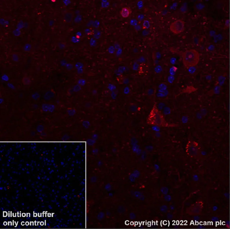 Immunohistochemistry (Formalin/PFA-fixed paraffin-embedded sections) - Alexa Fluor® 555 Anti-LC3B - Autophagosome Marker antibody [EPR18709] (AB307768)