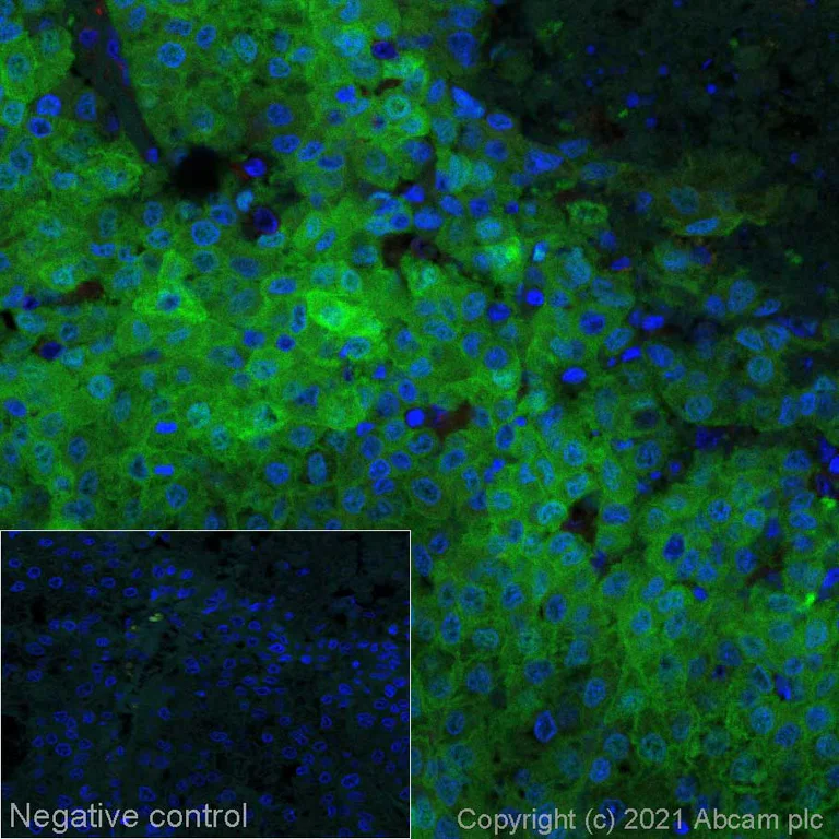 Immunohistochemistry (Formalin/PFA-fixed paraffin-embedded sections) - Alexa Fluor® 555 Anti-Liver Arginase antibody [EPR6672(B)] (AB280848)