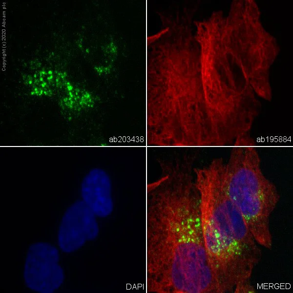 Immunocytochemistry - Alexa Fluor® 555 Anti-M6PR (cation independent) antibody [EPR6599] - Lysosome Membrane Marker (AB203438)
