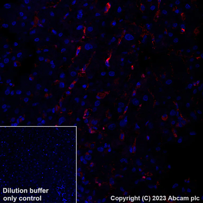 Immunohistochemistry (Formalin/PFA-fixed paraffin-embedded sections) - Alexa Fluor® 555 Anti-Mannose Receptor antibody [EPR22489-7] (AB313731)