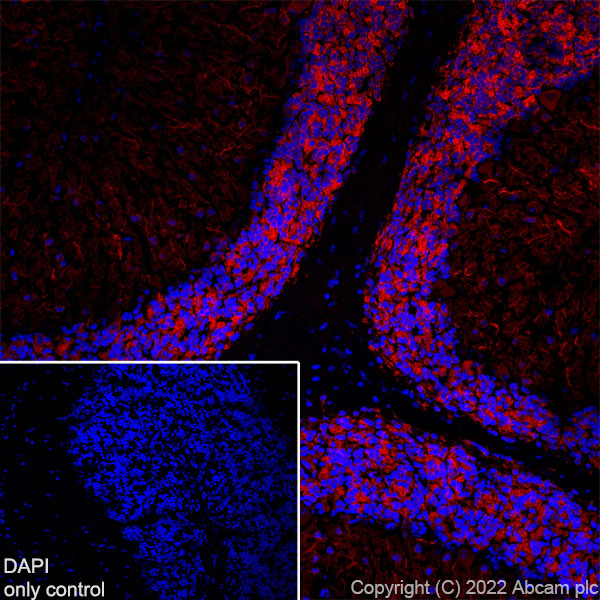 Immunohistochemistry (Frozen sections) - Alexa Fluor® 555 Anti-MAP2 antibody [EPR19691] - Neuronal Marker (AB302547), expandable thumbnail