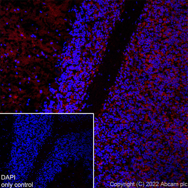 Immunohistochemistry (Frozen sections) - Alexa Fluor® 555 Anti-MAP2 antibody [EPR19691] - Neuronal Marker (AB302547), expandable thumbnail