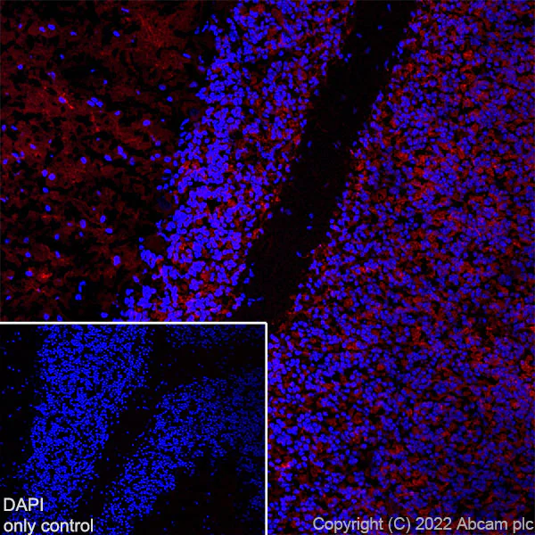 Immunohistochemistry (Frozen sections) - Alexa Fluor® 555 Anti-MAP2 antibody [EPR19691] - Neuronal Marker (AB302547)
