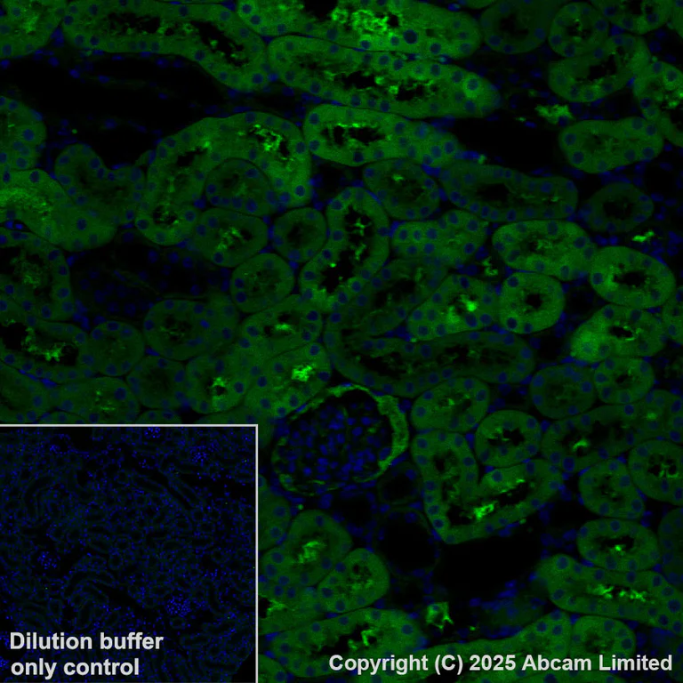 Immunohistochemistry (Formalin/PFA-fixed paraffin-embedded sections) - Alexa Fluor® 555 Anti-ME1 antibody [EPR28891-30] (AB325045)