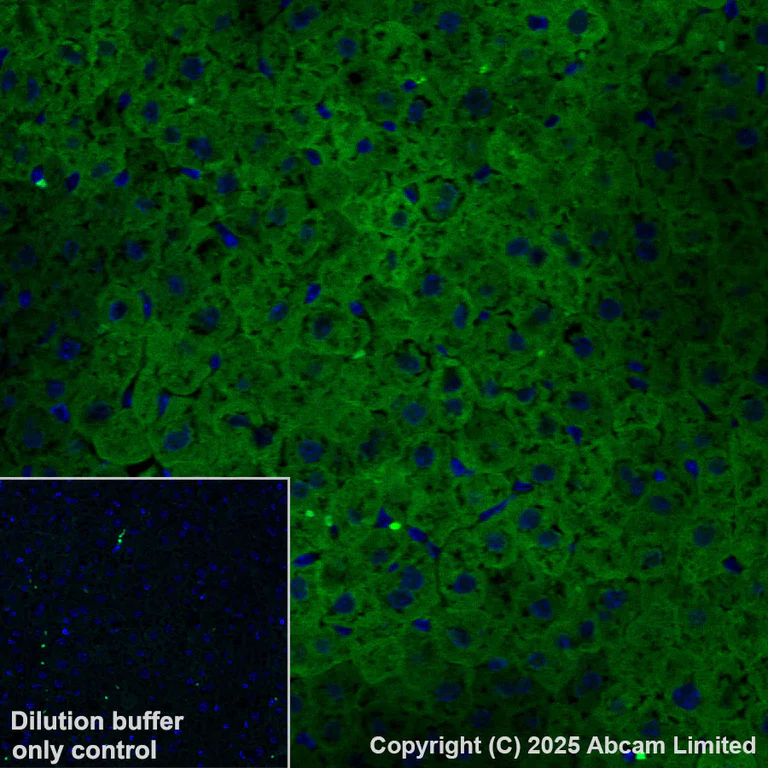 Immunohistochemistry (Formalin/PFA-fixed paraffin-embedded sections) - Alexa Fluor® 555 Anti-ME1 antibody [EPR28891-30] (AB325045)