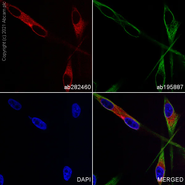 Immunocytochemistry/ Immunofluorescence - Alexa Fluor® 555 Anti-MelanA antibody [EP1422Y] (AB282460)