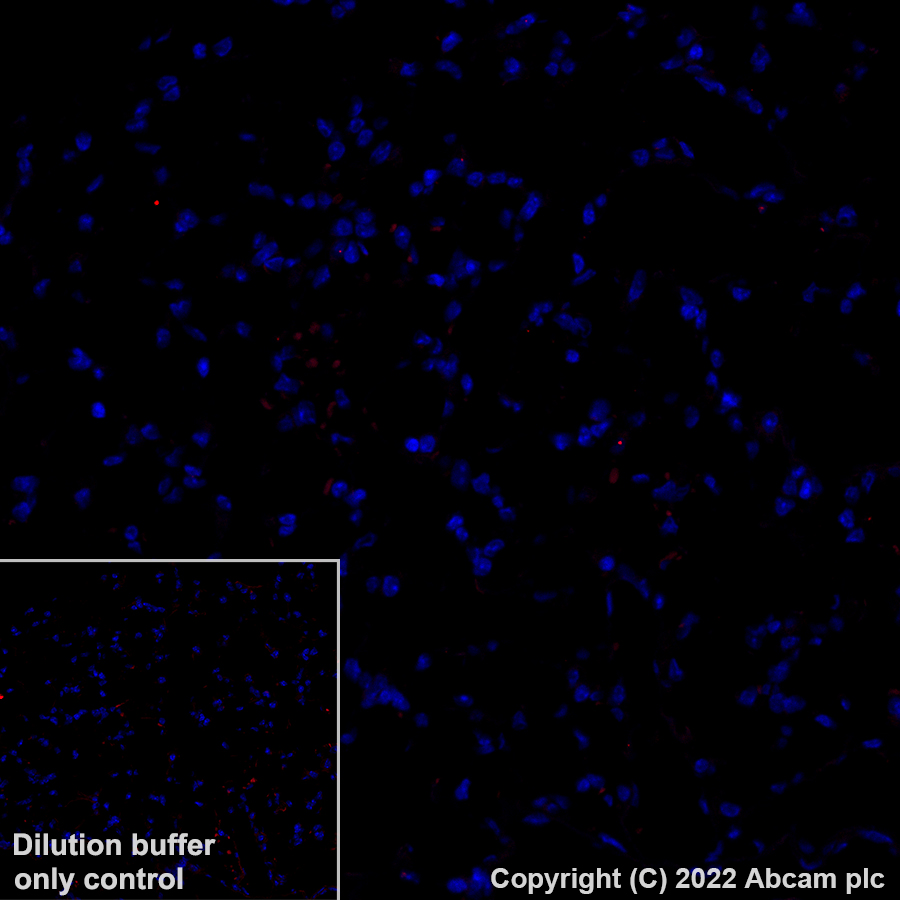 Immunohistochemistry (Formalin/PFA-fixed paraffin-embedded sections) - Alexa Fluor® 555 Anti-mGluR1a antibody [EPR24160-173] (AB307625), expandable thumbnail