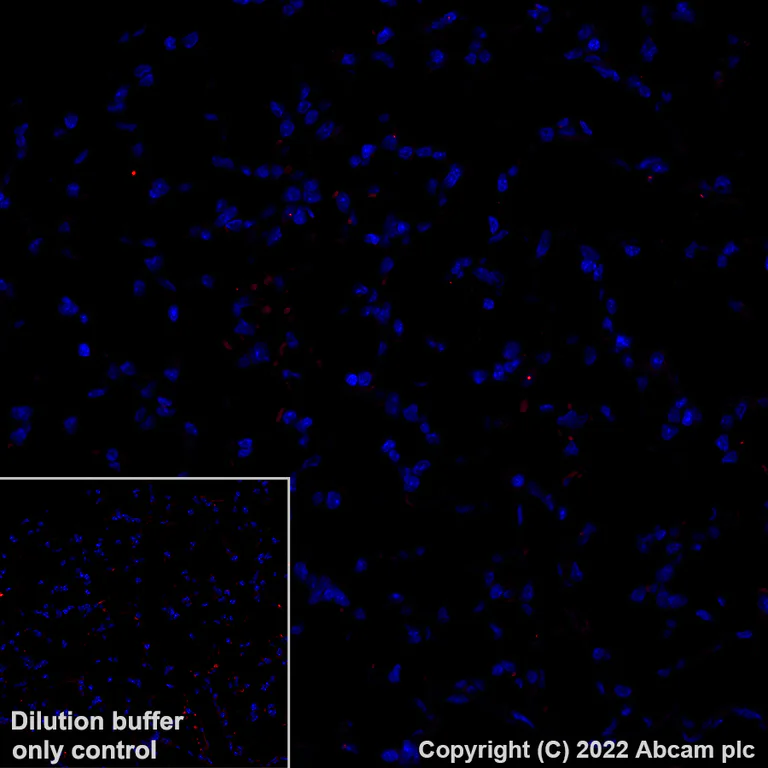Immunohistochemistry (Formalin/PFA-fixed paraffin-embedded sections) - Alexa Fluor® 555 Anti-mGluR1a antibody [EPR24160-173] (AB307625)