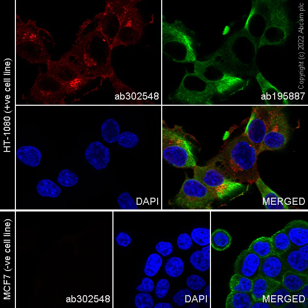 Immunocytochemistry - Alexa Fluor® 555 Anti-MMP14 antibody [EP1264Y] (AB302548)