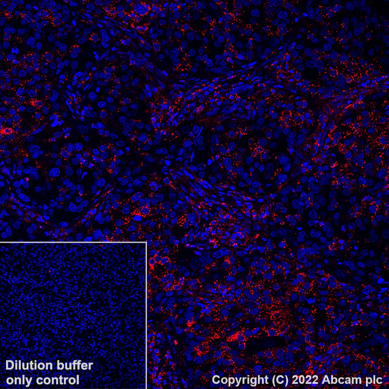 Immunohistochemistry (Formalin/PFA-fixed paraffin-embedded sections) - Alexa Fluor® 555 Anti-MX1 antibody [EPR24485-19] (AB307342)